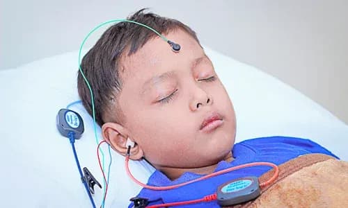 Pemeriksaan Pendengaran BERA & ASSR pada Anak Usia 3 Bulan – 2,5 Tahun