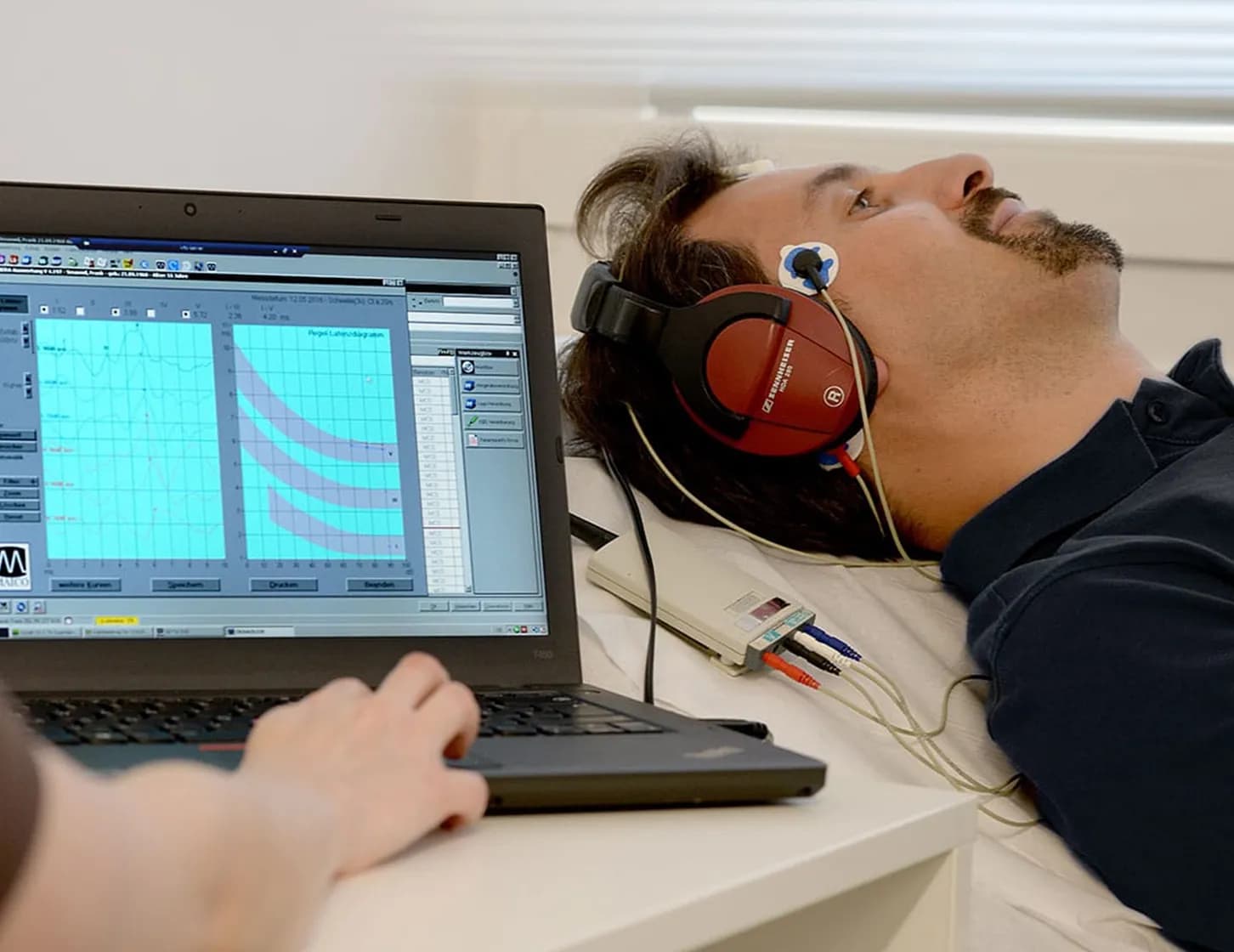 BERA (Brainstem Evoked Response Audiometry)