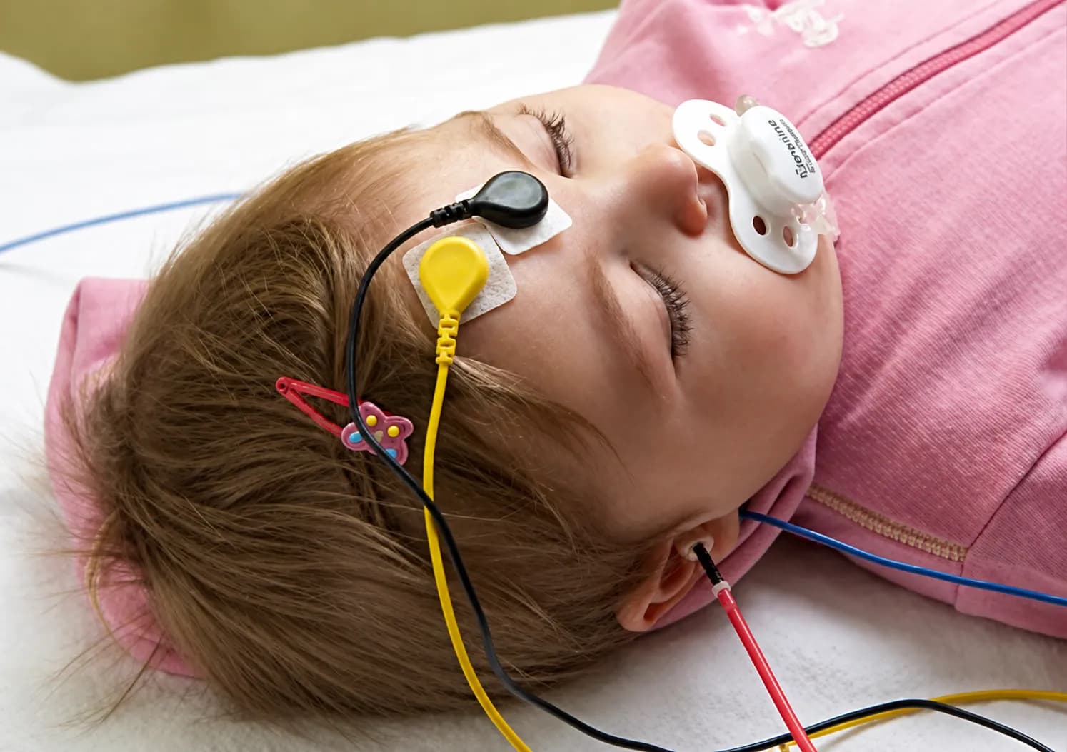Auditory Steady-State Response (ASSR)